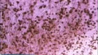 Penicillium Mold Growth [upl. by Inobe]