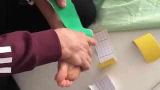 Sprain ankle taping  Eversion sprain [upl. by Somar486]