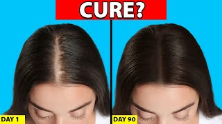 Womens Hair Loss Treatments That ACTUALLY WORK [upl. by Ssidnac]