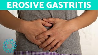 EROSIVE GASTRITIS  Belly Pain And Vomiting [upl. by Ludeman540]