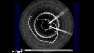 Emerging Applications for Optical Coherence Tomography in the Head Neck and Upper Airway [upl. by Nostrebor]