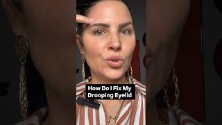 How Do I Fix My Droopy Eyelid botoxinjections dermalfillers educational facialaesthetics [upl. by Dualc]