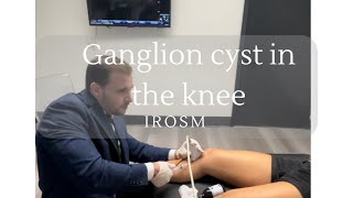 What is a ganglion cyst in the knee [upl. by Annawyt962]