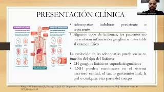 Pacientes con linfomas de alto grado implicaciones para el cuidado de Enfermería [upl. by Ariat38]