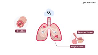 Was ist eine chronisch obstruktive Lungenerkrankung COPD [upl. by Menendez664]