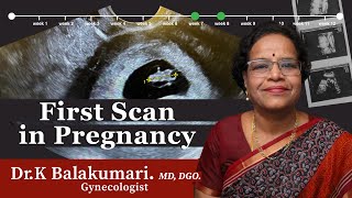 FIRST SCAN in pregnancy [upl. by Lap]