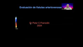 28 Evaluación de fístulas para hemodiálisis  Dr Francolin [upl. by Doner]