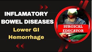 INFLAMMATORY BOWEL DISEASE  How To DIAGNOSE amp TREAT Lower GI Hemorrhage [upl. by Vick839]