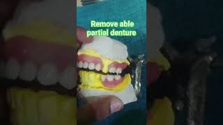 remove able partial denture by Ali dental ceramic and idea removabledenture partialdenture dentis [upl. by Yerhcaz]