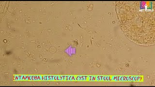 Entamoeba histolytica cyst in stool microscopy [upl. by Eetsirhc]