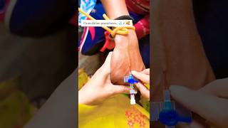 Iv cannulation procedure 🧑‍⚕️😷 shorts cannula trending youtubeshorts mbbs doctor love song [upl. by Denzil]