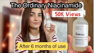 The Ordinary Niacinamide 10  zinc 1 Review WHAT ARE THE RESULTS after 6 months of USE [upl. by Everett]