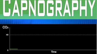 EtCO2 Capnography Part 6 [upl. by Atiuqihc]