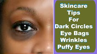 Get Rid of Dark Circles FAST with These Shocking Skincare Tips [upl. by Ayifa]