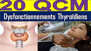 20 QCM Hyperthyroïdie ou Hypothyroïdie  Découvrez les Causes et Solutions [upl. by Say]