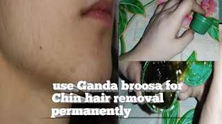 ganda brozaRemove chin hair permanentlyhow to use Ganda brozaremove unwanted hair [upl. by Huoh]