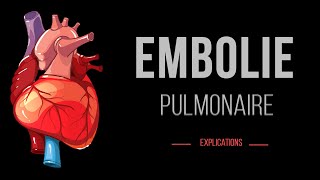 Embolie Pulmonaire  Cardiologie Urgence  Détails [upl. by Adala]