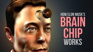 I Tried Elon Musks Brain Chip [upl. by Velvet576]