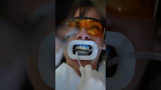 Teeth Whitening ASMR [upl. by Airotnahs]