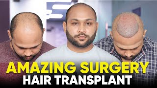 Hair Transplant in Guwahati  Best Results amp Cost of Hair Transplant in Guwahati [upl. by Nosrak]