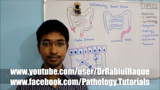 Inflammatory Bowel Disease HD [upl. by Pasadis604]