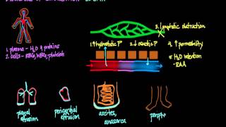 Disorders of Circulation Edema [upl. by Ahsilad]