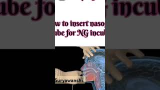 Ryels tube insertionNG tube insertionbscnursing2022 medicalstudent [upl. by Willdon]