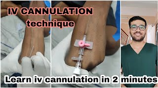 LEARN IV CANNULATION IN 2 MINUTES  How to do iv cannulation  iv cannulationmedical mbbs nursing [upl. by Charlean]