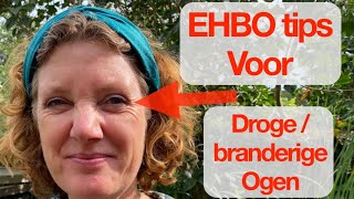 EHBO tips drogebranderige ogen [upl. by Nyliak588]