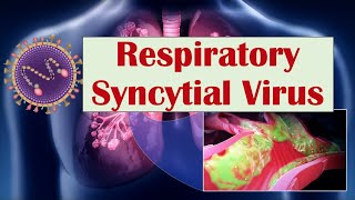 Respiratory Syncytial Virus RSV  What Is It amp What Conditions Does it Cause ex Croup [upl. by Armando]