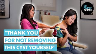 quotThank You for Not Removing this Cyst Yourselfquot Dr Lee Meets J Before Her Cyst Procedure [upl. by Aurel]