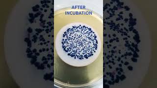 Membrane Filtration Technique  E coli  Coliform bacteria microbiology shorts viral [upl. by Naesal]