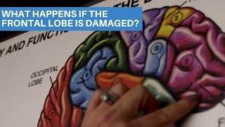 What Happens If The Frontal Lobe Is Damaged [upl. by Annairdua548]