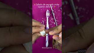 Tallado segundo molar superior derecho ✨🦷 odontologia talladodemolar anatomiadental [upl. by Annasiul]