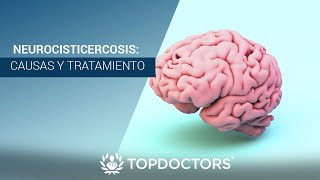 Neurocisticercosis causas y tratamiento [upl. by Enilasor578]