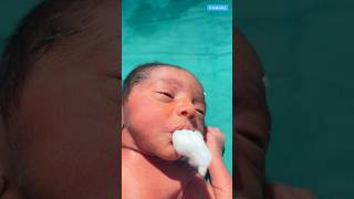 This Newborn Little Hungry medical viralshort [upl. by Nhor]