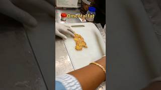 Omental fat tissue for histopathology processing [upl. by Ioyal713]