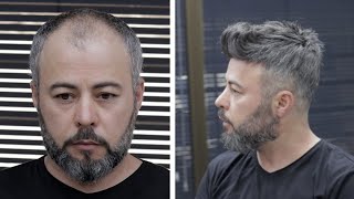 PROTEZ SAÇ UYGULAMASI  Hair Replacement [upl. by Brest747]