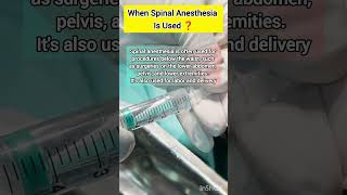 When Spinal Anesthesia is used in surgery  doctor mbbs neet medical anesthesia medicalstudent [upl. by Llemaj]