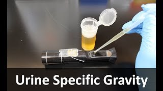 Urine Specific Gravity Refractometer [upl. by Obara360]