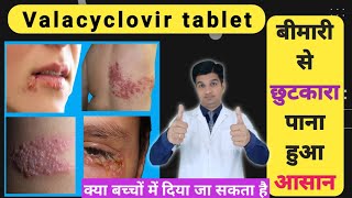 नहीं सहनी पड़ेगी यह दर्दनाक बीमारी  Valcivir 1000 mg tablet uses in hindi [upl. by Rramaj]