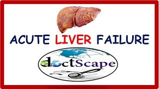 ACUTE LIVER FAILURE by DoctScape [upl. by Adnahcir200]