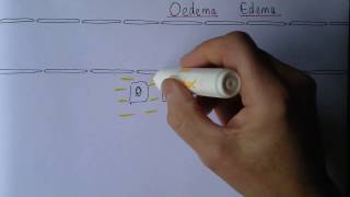 Edema exudates or transudates [upl. by Mosier]