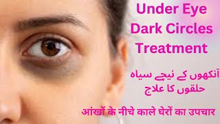 Under Eye Dark Circles Treatment face care tips for women pakistani skincare [upl. by Bunns293]