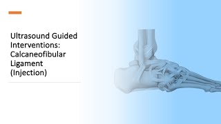 ultrasound Guided Interventions CFL injection fyp sport sports sportsmedicine [upl. by Llehsyar]