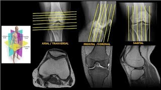 Resonancia Magnética de Rodilla Anatomía parte 1 [upl. by Mellette478]