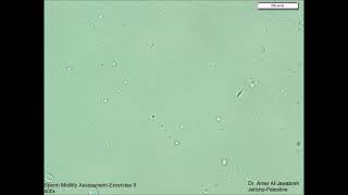 Sperm Motility Assessment exercise 9 [upl. by Manlove]