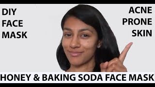 How To Remove Acne Scars  Baking Soda amp Honey Face Mask TUTORIAL [upl. by Ellehcrad]