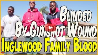 Munchie B from Inglewood Family Bloods lost vision after getting shot in head pt1of2 [upl. by Rabkin]