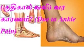 கணுக்கால் வலி குதிகால் வலி வர காரணம் Due to Ankle Pain [upl. by Magdalene]